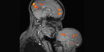 MIT’s McGovern Institute is shaping mind science and enhancing human lives on a worldwide scale | MIT Information