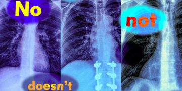 Research reveals vision-language fashions can’t deal with queries with negation phrases | MIT Information