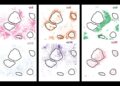 New AI system uncovers hidden cell subtypes, boosts precision medication | MIT Information