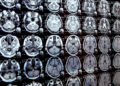 New AI system might speed up scientific analysis | MIT Information