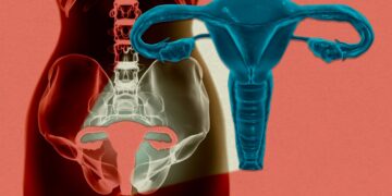 A lady’s uterus has been stored alive exterior the physique for the primary time
