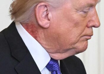 Donald Trump’s Neck Appears to be like Contaminated With Resident Evil’s T-Virus