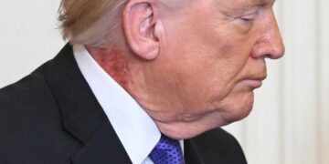 Donald Trump’s Neck Appears to be like Contaminated With Resident Evil’s T-Virus