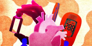 Testing for ‘Dangerous Ldl cholesterol’ Doesn’t Inform the Entire Story