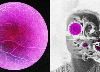 Longevity Startup Doses First Human in Bid to Reverse Age-Associated Sight Loss