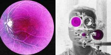 Longevity Startup Doses First Human in Bid to Reverse Age-Associated Sight Loss
