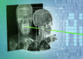 New AI method might make minimally invasive surgical procedures safer and extra exact | MIT Information