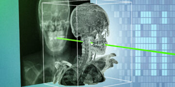 New AI method might make minimally invasive surgical procedures safer and extra exact | MIT Information